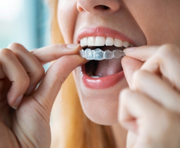 kobieta umieszczająca kawałek plastiku na zębach